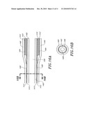 ULTRASOUND CATHETER WITH EMBEDDED CONDUCTORS diagram and image