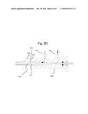 INTRACORPOREAL GAS EXCHANGE DEVICES, SYSTEMS AND METHODS diagram and image