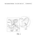 BIOPSY GUIDANCE BY IMAGE-BASED X-RAY GUIDANCE SYSTEM AND PHOTONIC NEEDLE diagram and image