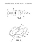 BIOPSY GUIDANCE BY IMAGE-BASED X-RAY GUIDANCE SYSTEM AND PHOTONIC NEEDLE diagram and image