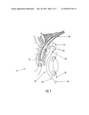 OCULAR DRUG DELIVERY DEVICE diagram and image