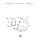 OCULAR DRUG DELIVERY DEVICE diagram and image