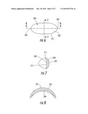 OCULAR DRUG DELIVERY DEVICE diagram and image