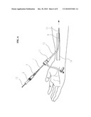 CATHETER ASSEMBLY diagram and image