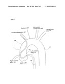 CATHETER ASSEMBLY diagram and image