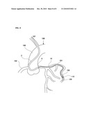 CATHETER ASSEMBLY diagram and image