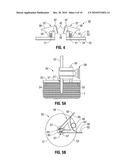 Ablation Probe Fixation diagram and image