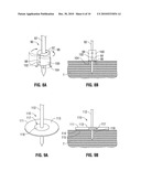 Ablation Probe Fixation diagram and image