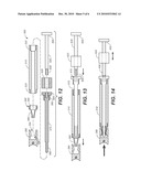 MULTI-ARTICULATED FRACTURE FIXATION DEVICE WITH ADJUSTABLE MODULUS OF RIGIDITY diagram and image