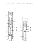 INTRACORPOREAL GRASPING DEVICE diagram and image