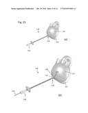 DEVICE AND METHOD FOR PERFORMING TREATMENT IN A PERICARDIAL SPACE diagram and image