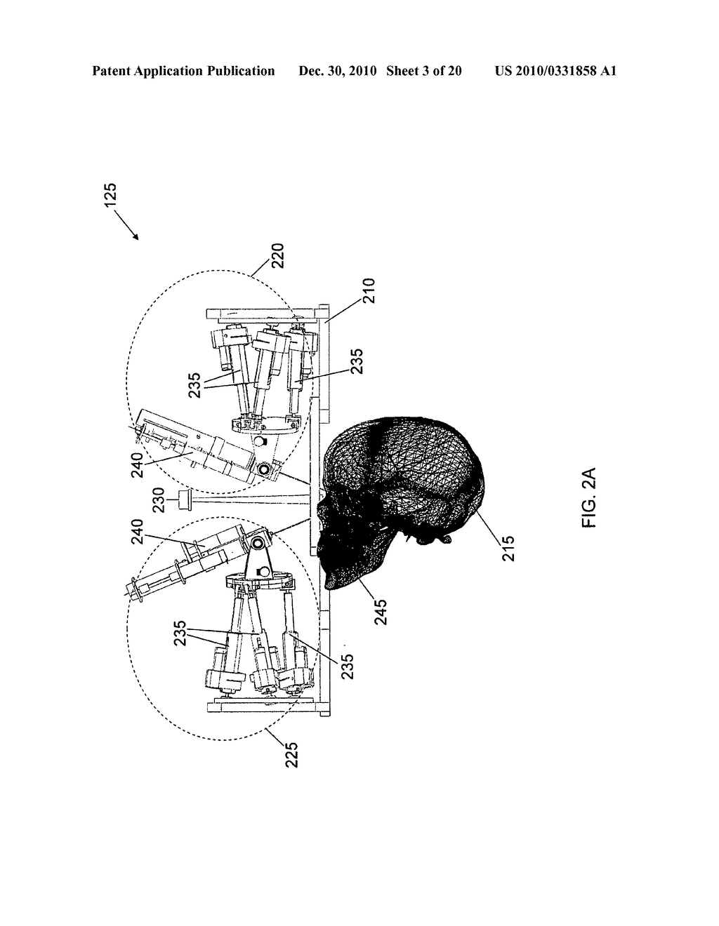 SYSTEMS, DEVICES, AND METHODS FOR ROBOT-ASSISTED MICRO-SURGICAL STENTING - diagram, schematic, and image 04