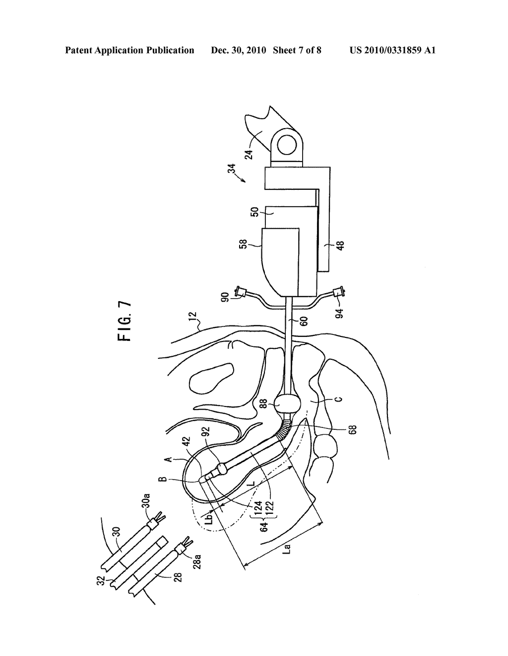 MEDICAL ROBOT SYSTEM FOR SUPPORTING AN ORGAN IN A POSITION SUITABLE FOR A MEDICAL TREATMENT - diagram, schematic, and image 08