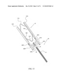 TISSUE COMPRESSION USING SURGICAL CLIPS diagram and image