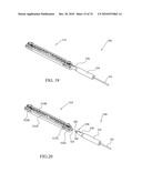 TISSUE COMPRESSION USING SURGICAL CLIPS diagram and image