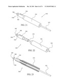 TISSUE COMPRESSION USING SURGICAL CLIPS diagram and image