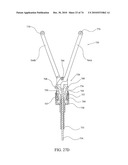 TISSUE COMPRESSION USING SURGICAL CLIPS diagram and image