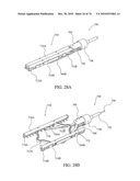 TISSUE COMPRESSION USING SURGICAL CLIPS diagram and image