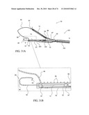 TISSUE COMPRESSION USING SURGICAL CLIPS diagram and image