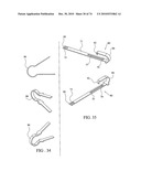 TISSUE COMPRESSION USING SURGICAL CLIPS diagram and image