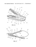 TISSUE COMPRESSION USING SURGICAL CLIPS diagram and image