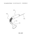 TISSUE COMPRESSION USING SURGICAL CLIPS diagram and image