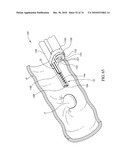 TISSUE COMPRESSION USING SURGICAL CLIPS diagram and image