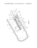 TISSUE COMPRESSION USING SURGICAL CLIPS diagram and image