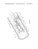 TISSUE COMPRESSION USING SURGICAL CLIPS diagram and image