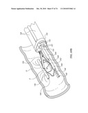 TISSUE COMPRESSION USING SURGICAL CLIPS diagram and image