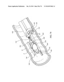 TISSUE COMPRESSION USING SURGICAL CLIPS diagram and image