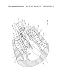 TISSUE COMPRESSION USING SURGICAL CLIPS diagram and image