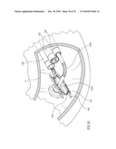 TISSUE COMPRESSION USING SURGICAL CLIPS diagram and image