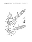 Longitudinal connecting member with sleeved tensioned cords diagram and image