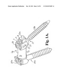 Longitudinal connecting member with sleeved tensioned cords diagram and image