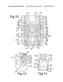 Longitudinal connecting member with sleeved tensioned cords diagram and image