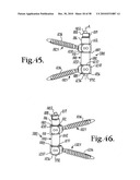 Longitudinal connecting member with sleeved tensioned cords diagram and image