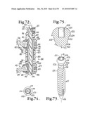 Longitudinal connecting member with sleeved tensioned cords diagram and image