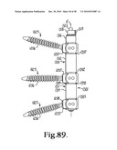 Longitudinal connecting member with sleeved tensioned cords diagram and image