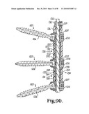 Longitudinal connecting member with sleeved tensioned cords diagram and image