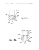 Longitudinal connecting member with sleeved tensioned cords diagram and image