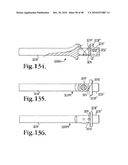 Longitudinal connecting member with sleeved tensioned cords diagram and image