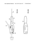 SURGICAL TOOLS FOR TREATMENT OF SPINAL STENOSIS diagram and image