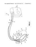 HEART SOUND SENSING TO REDUCE INAPPROPRIATE TACHYARRHYTHMIA THERAPY diagram and image