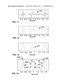 HEART SOUND SENSING TO REDUCE INAPPROPRIATE TACHYARRHYTHMIA THERAPY diagram and image