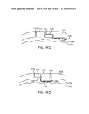 MICROSTIMULATOR WITH FLAP ELECTRODES diagram and image