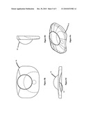 Method of Reducing Loading Failure for a Prosthetic Component diagram and image