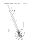 Bone fusion device and methods diagram and image