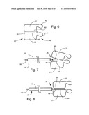 Bone fusion device and methods diagram and image