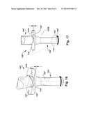 MULTI-PIECE PROSTHETIC JOINT COMPONENT diagram and image